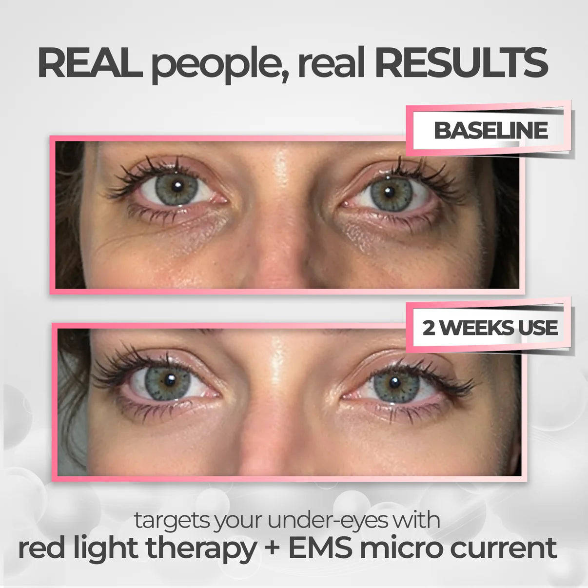 Aurea®  Under-Eye Red Light Therapy